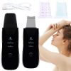 Ultrahangos peeling készülék