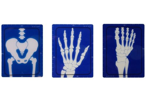 Orvosi készlet Készülékek Orvosi tartozékok X-ray Doktor